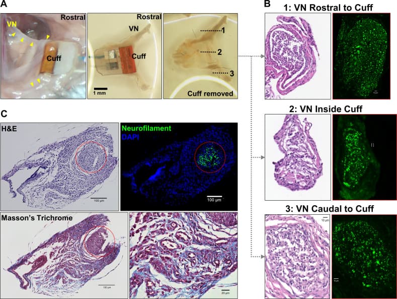 Histology of the implanted vagus nerve shows preserved fibers and intact neurofilaments at three weeks.