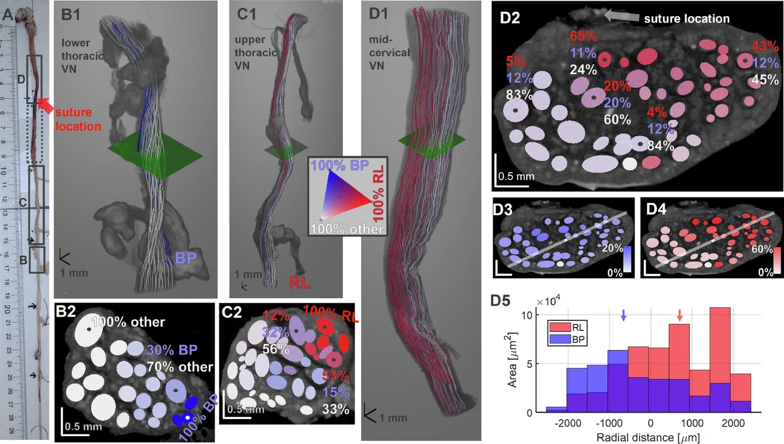 Bronchopulmonary- and recurrent laryngeal-specific fascicles progressively merge, giving rise to a bimodal anatomical organization at the cervical level.