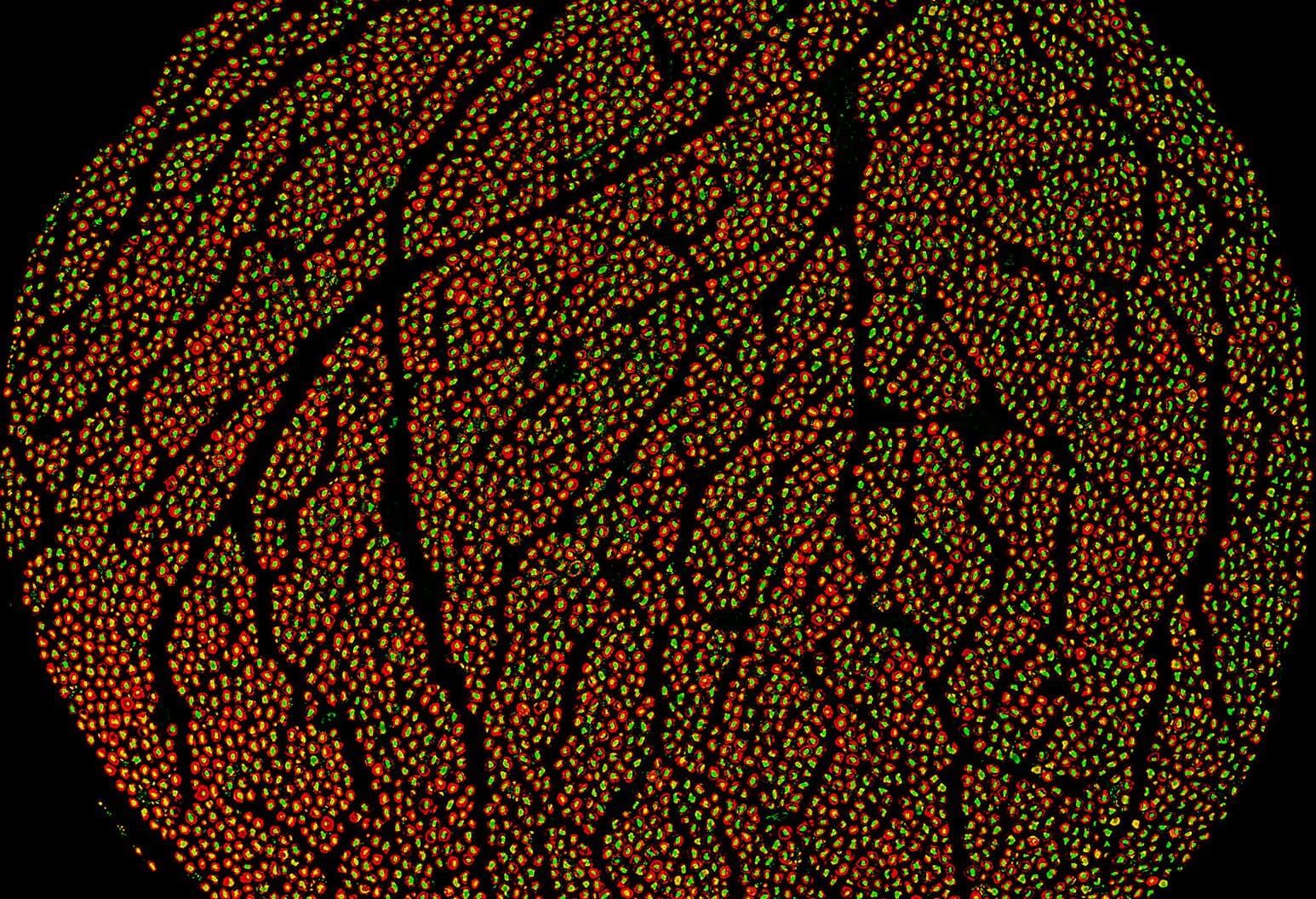 Cross-section of a human vagus nerve from the REVA dataset, with individual fibers mapped across the fascicles.